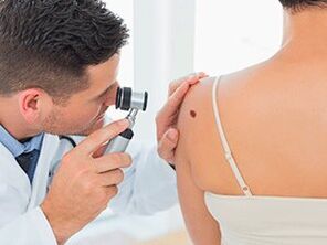 the doctor examines the papilloma and recommends its removal with drugs