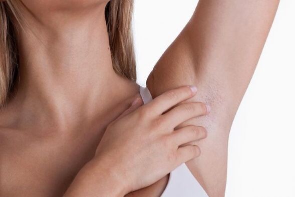 papillomas in the armpits of a woman