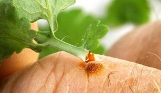How to clean wart with celandine